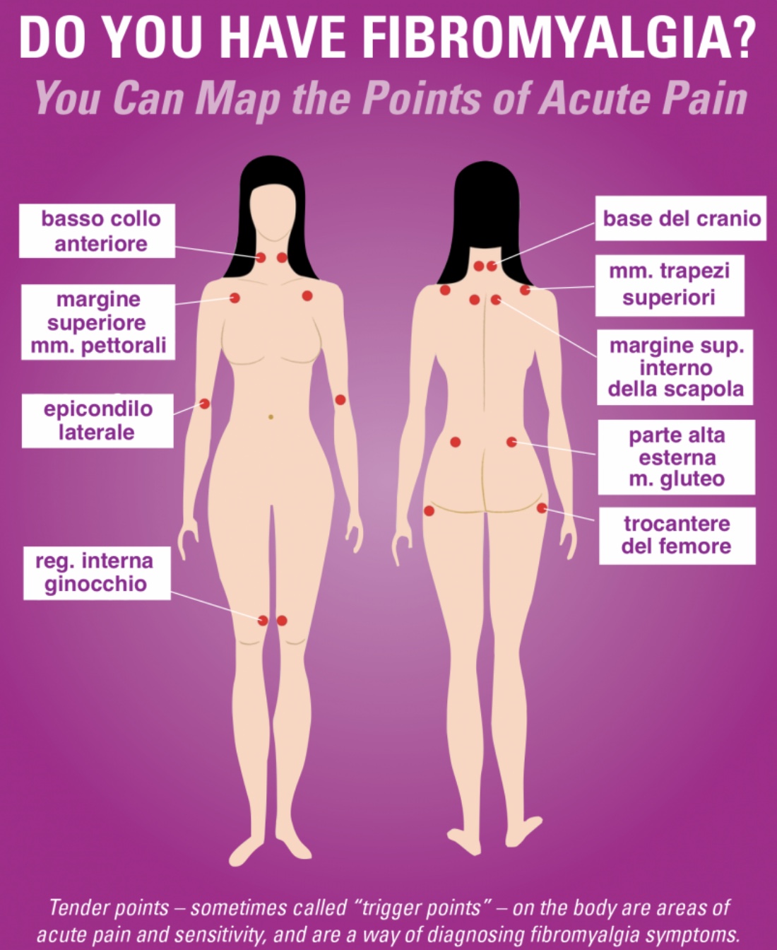 Fibromialgia