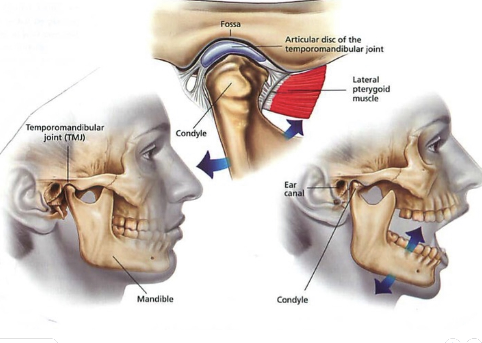 Мыщелки нижней челюсти. Дисфункции ВНЧС нижней челюсти. Мышцы височно-нижнечелюстного сустава анатомия.